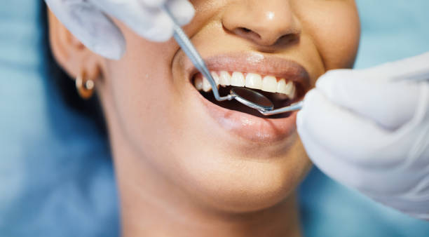 Best Emergency Denture Repair in Hockinson, WA